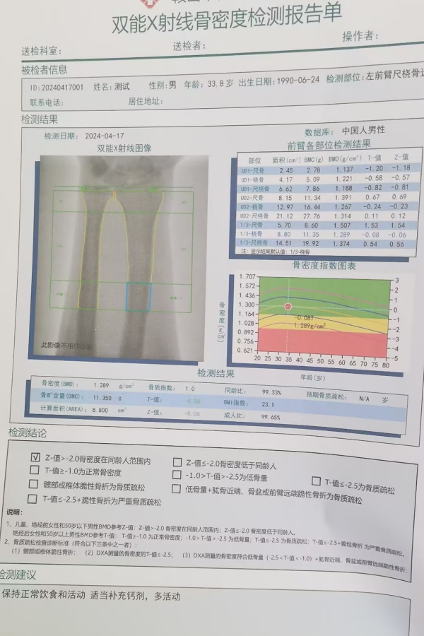 双能X射线骨密度仪:准确测量骨密度,助力骨质疏松防治,守护骨骼健康 双能X射线骨密度仪:准确测量骨密度,助力骨质疏松防治,守护骨骼健康